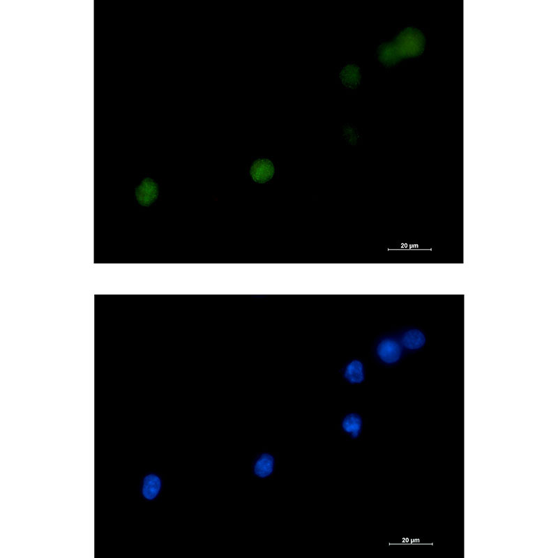 2 - [KD]DKC1 Rabbit mAb AP75361