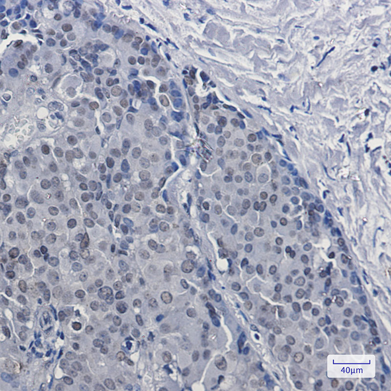 0 - [KD]DKC1 Rabbit mAb AP75361