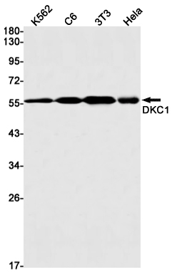 8 - [KD]DKC1 Rabbit mAb AP75361