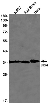 3 - DLX4 Rabbit mAb AP75363