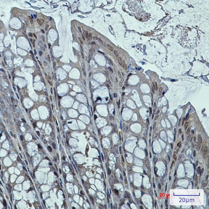 1 - DNAJB6 Rabbit mAb AP75366