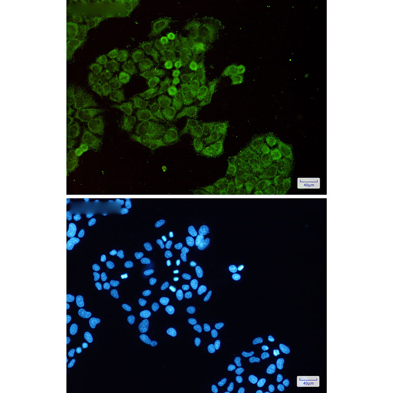 8 - Dnmt1 Rabbit mAb AP75367
