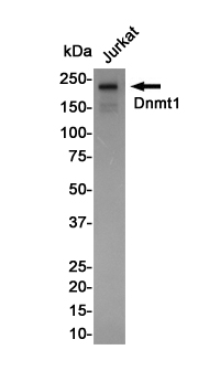 1 - Dnmt1 Rabbit mAb AP75367
