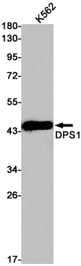 1 - DPS1 Rabbit mAb AP75373