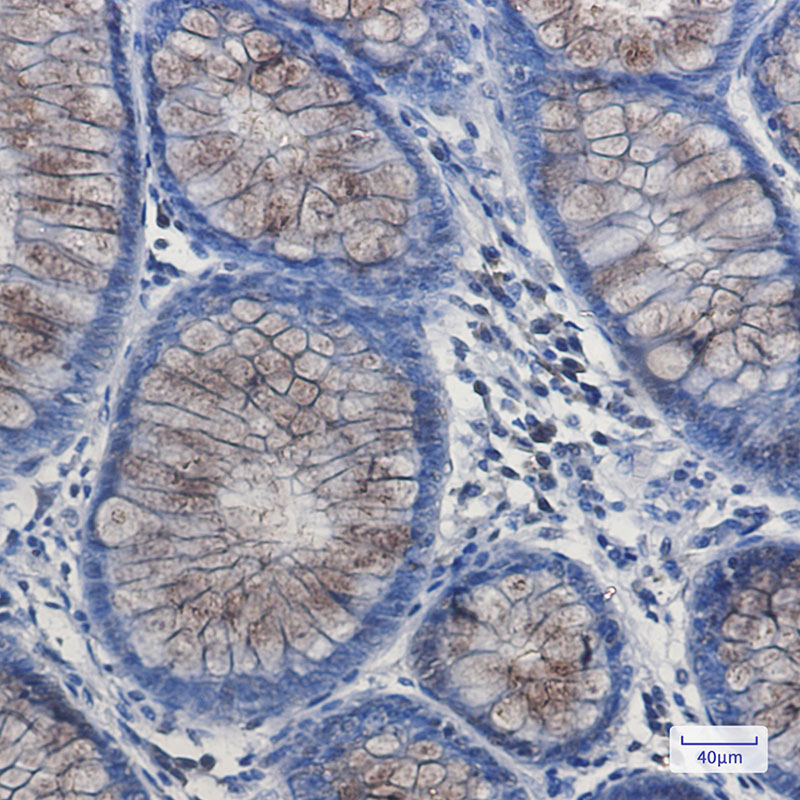 2 - DYNLL1/PIN Rabbit mAb AP75374