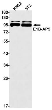 1 - [KO]E1B AP5 Rabbit mAb AP75375
