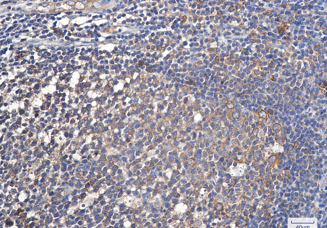 2 - eEF1A1/EF-Tu Rabbit mAb AP75377