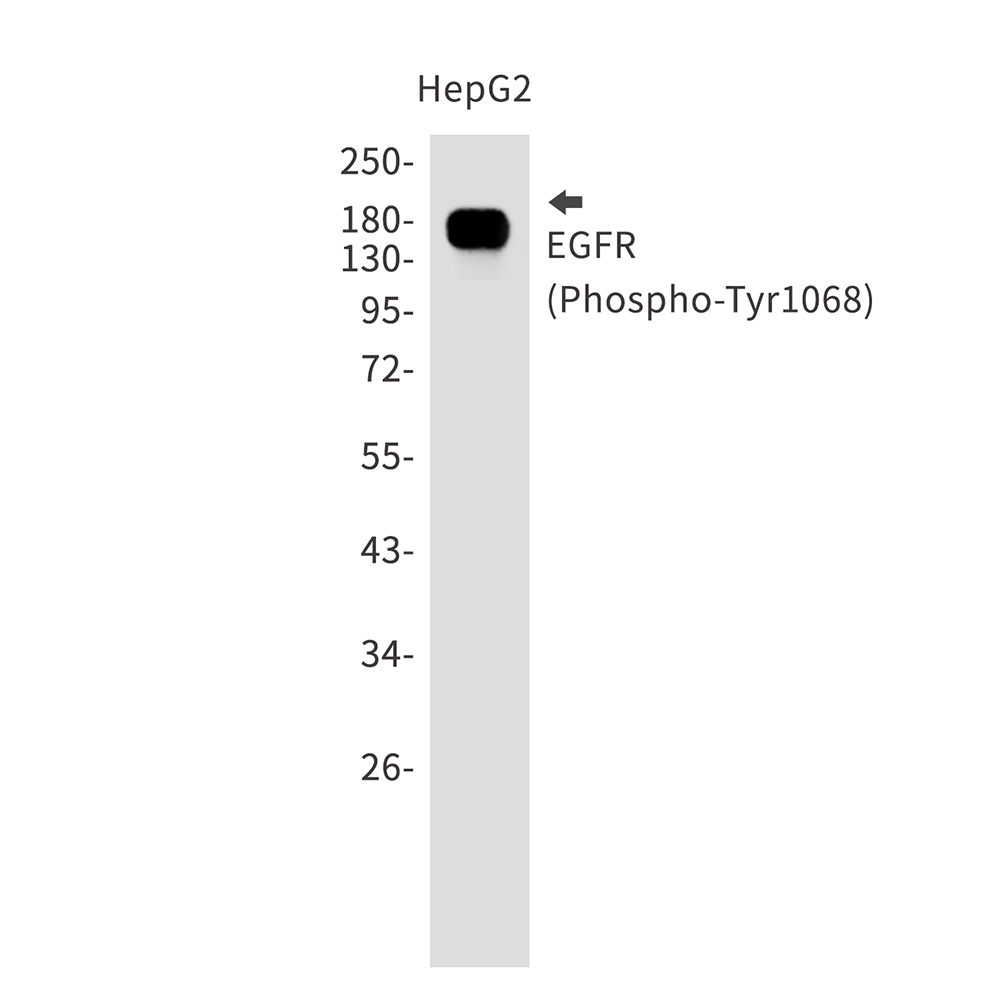 1 - [KO]Phospho-EGFR (Tyr1068) Rabbit mAb AP75378