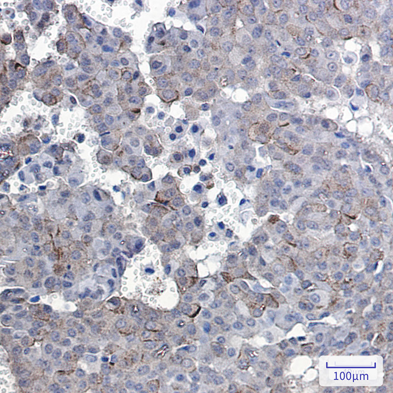 2 - Phospho-EGFR (Tyr1092) Rabbit mAb AP75379