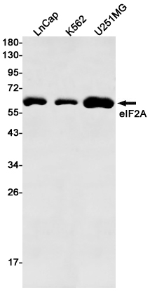 2 - eIF2A Rabbit mAb AP75386