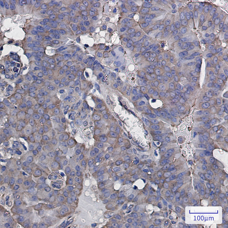 2 - eIF3B Rabbit mAb AP75387
