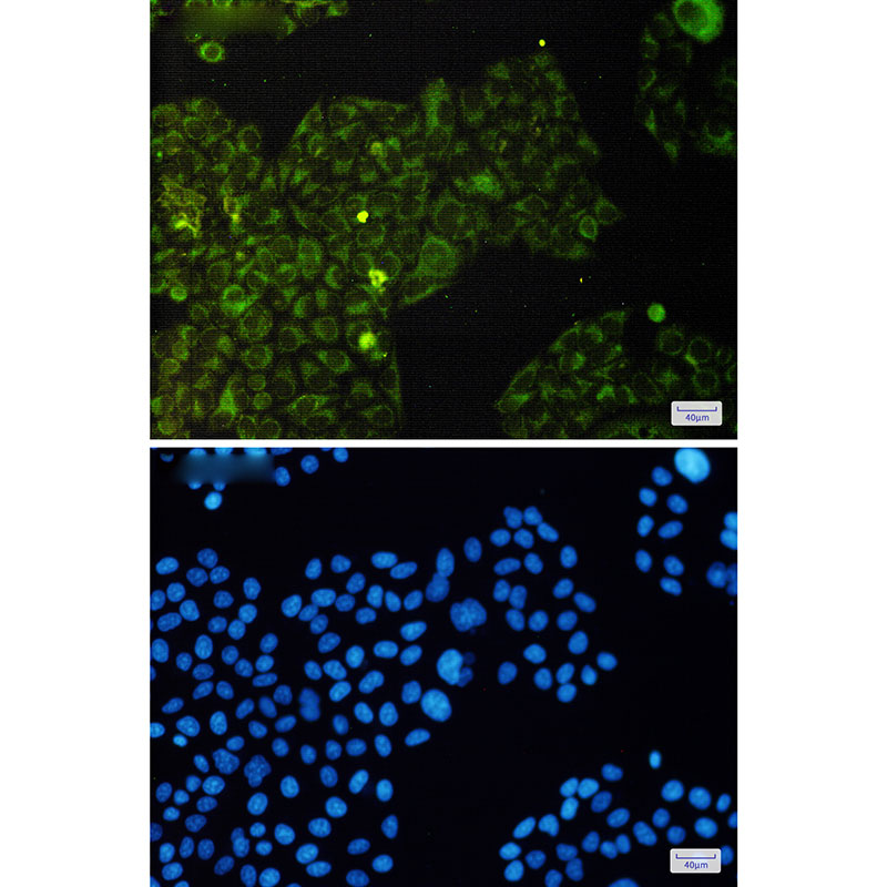 2 - Phospho-eIF4E (Ser209) Rabbit mAb AP75391
