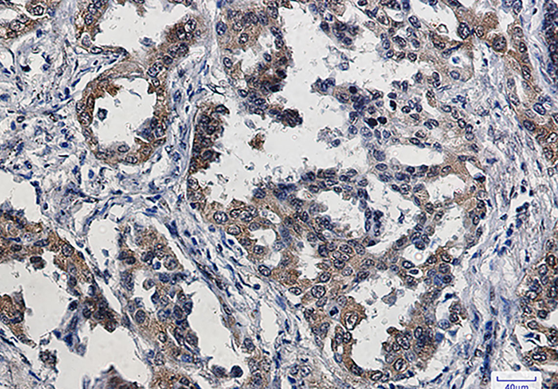 8 - Phospho-eIF4E (Ser209) Rabbit mAb AP75391