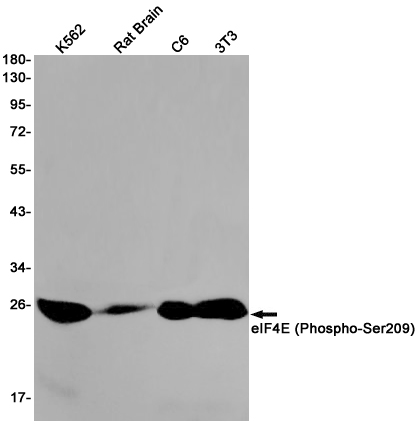 1 - Phospho-eIF4E (Ser209) Rabbit mAb AP75391
