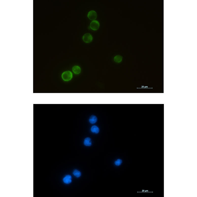 1 - ELMO1 Rabbit mAb AP75396