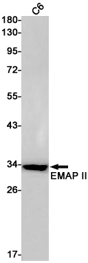 0 - [KO]EMAP II Rabbit mAb AP75397