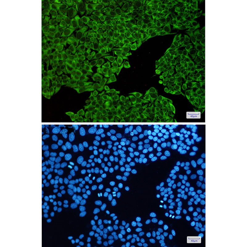 8 - ENO3 Rabbit mAb AP75400