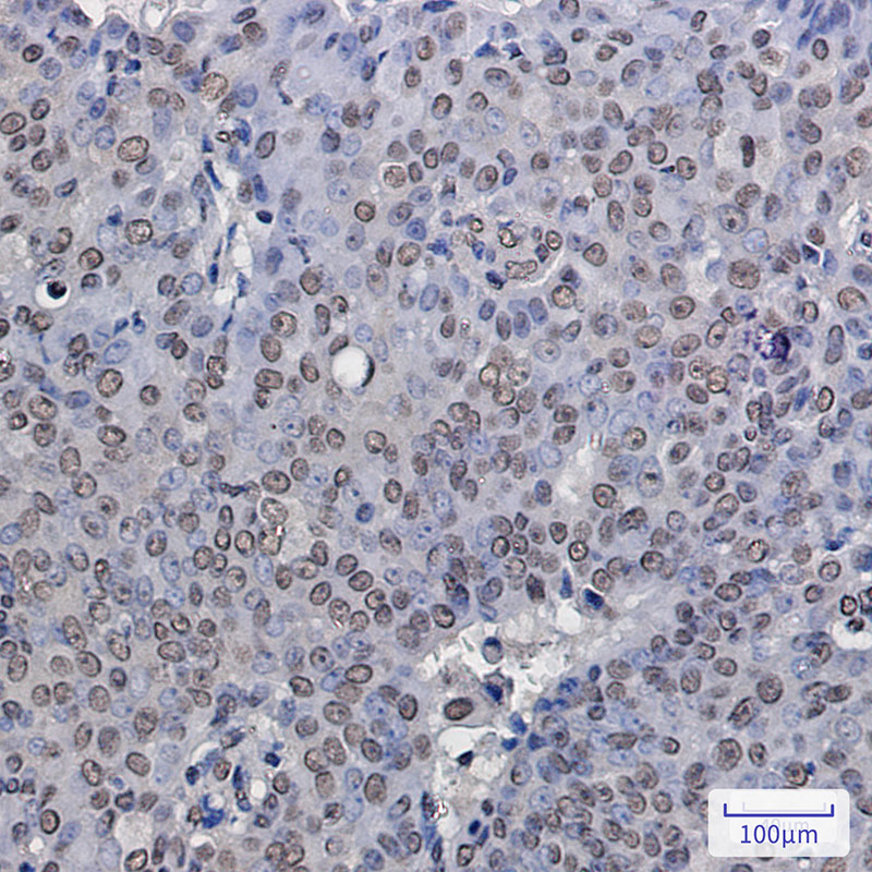2 - ENT2 Rabbit mAb AP75403