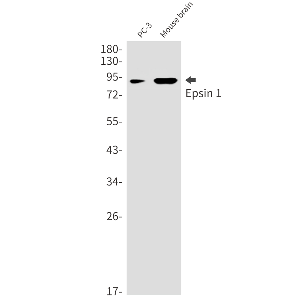 1 - Epsin 1 Rabbit mAb AP75408