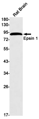 3 - Epsin 1 Rabbit mAb AP75408