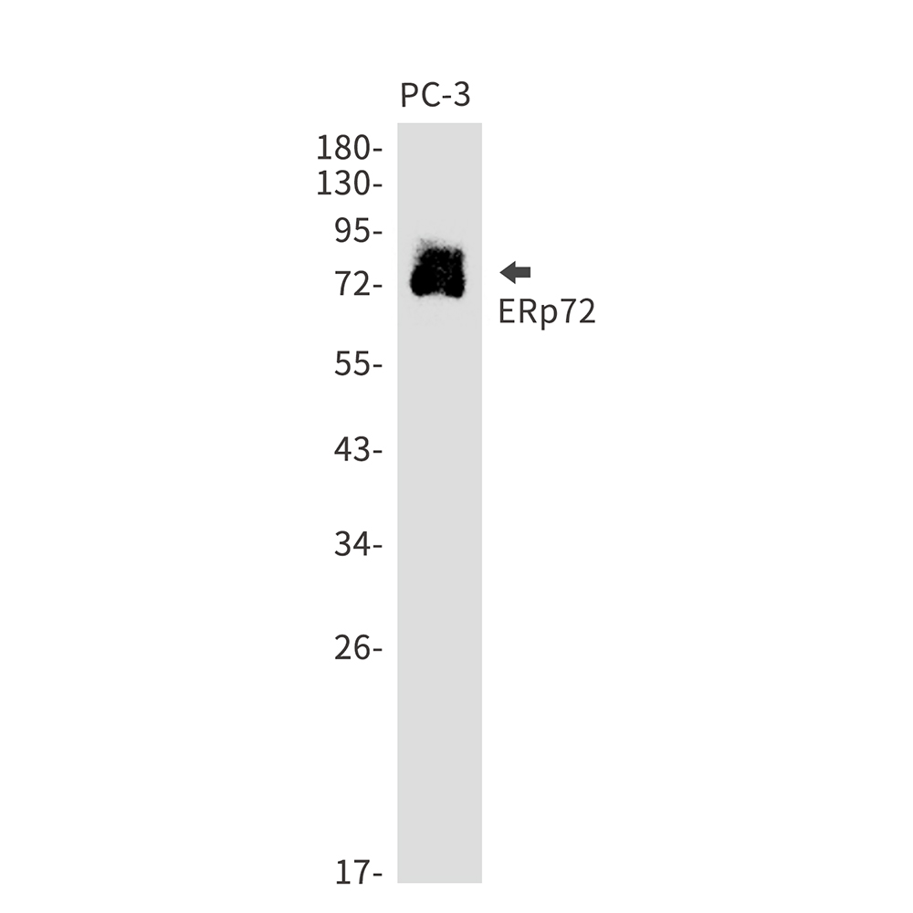1 - ERp72 Rabbit mAb AP75411