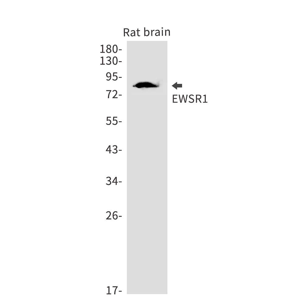 1 - EWSR1 Rabbit mAb AP75415