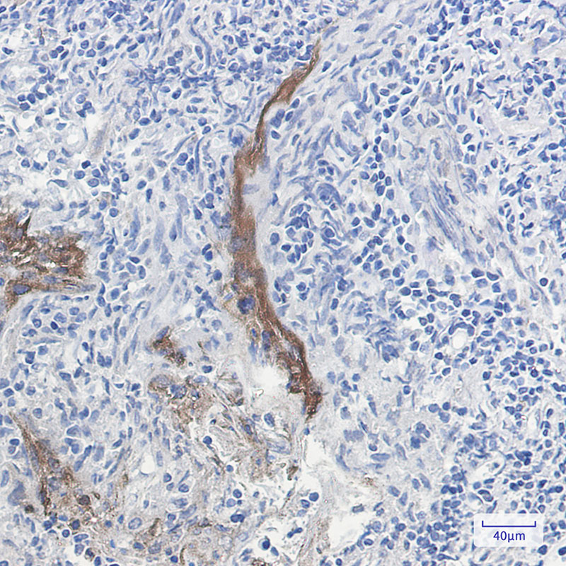 8 - Extracellular Matrix Protein 1 Rabbit mAb AP75417