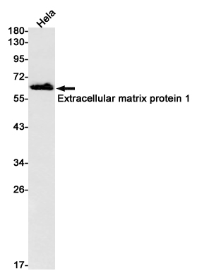 2 - Extracellular Matrix Protein 1 Rabbit mAb AP75417
