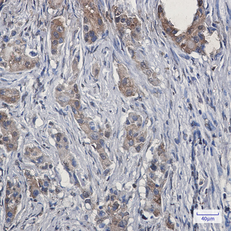 2 - Ezrin Rabbit mAb AP75418