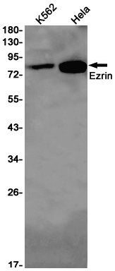 1 - Ezrin Rabbit mAb AP75418