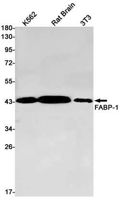1 - Aspartate Aminotransferase Rabbit mAb AP75419