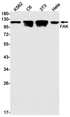 2 - FAK Rabbit mAb AP75423