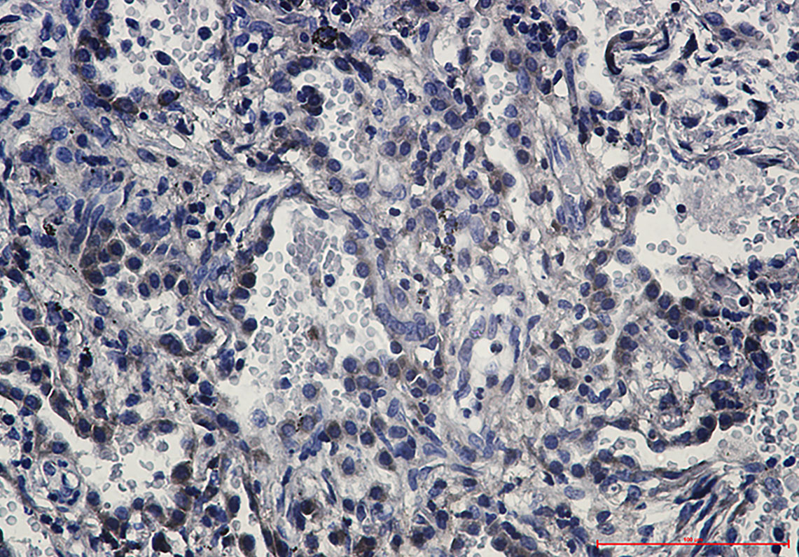 8 - Fas Rabbit mAb AP75427