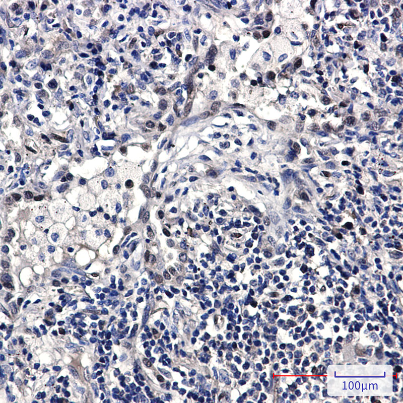 2 - FDPS/FPS Rabbit mAb AP75431