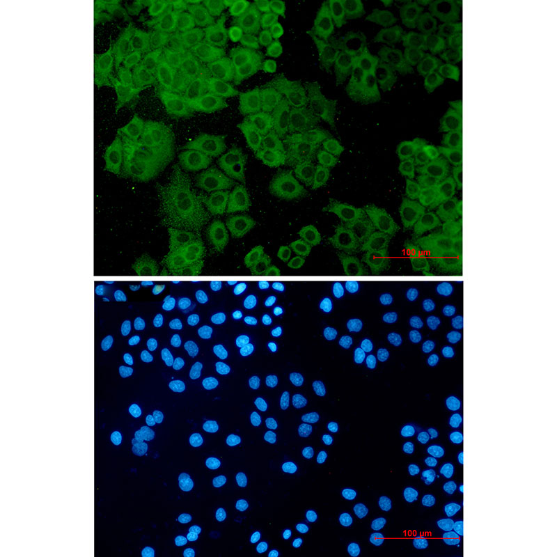 4 - FH/Fumarase Rabbit mAb AP75435