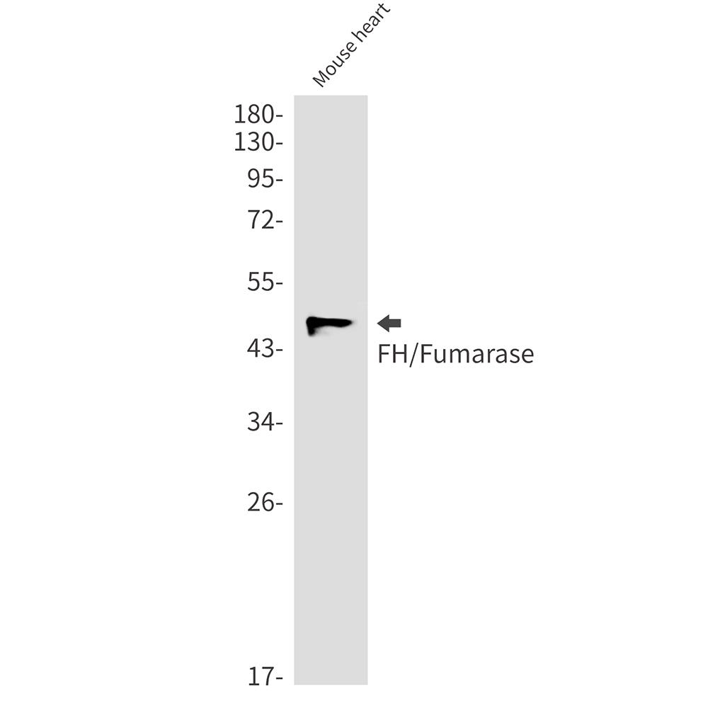 1 - FH/Fumarase Rabbit mAb AP75435