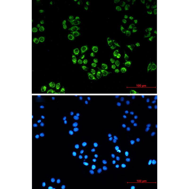 4 - FH/Fumarase Rabbit mAb AP75436