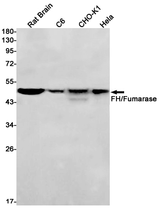 2 - FH/Fumarase Rabbit mAb AP75436
