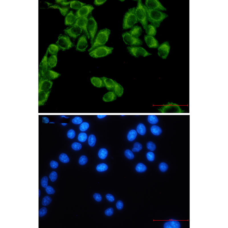 4 - FH/Fumarase Rabbit mAb AP75437