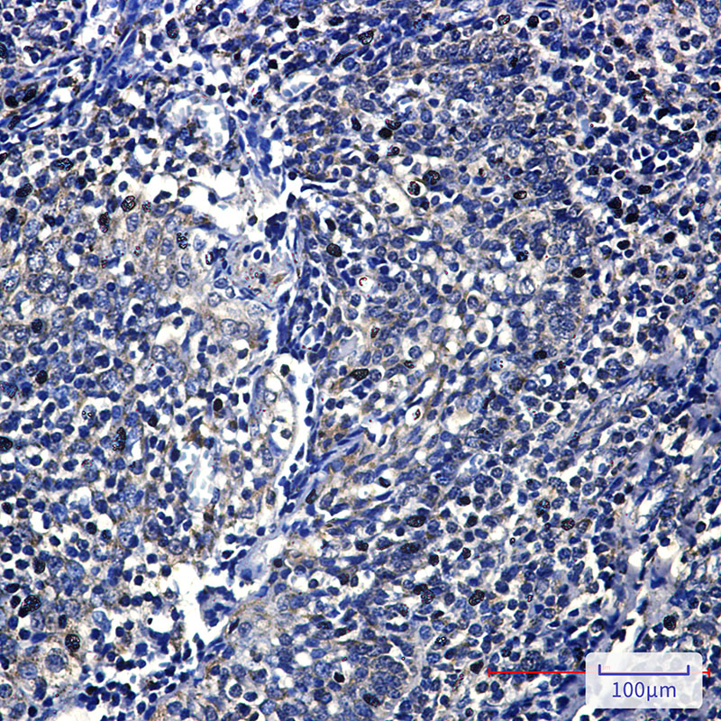 8 - FH/Fumarase Rabbit mAb AP75437