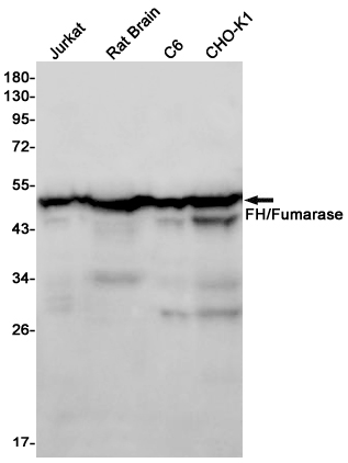 2 - FH/Fumarase Rabbit mAb AP75437