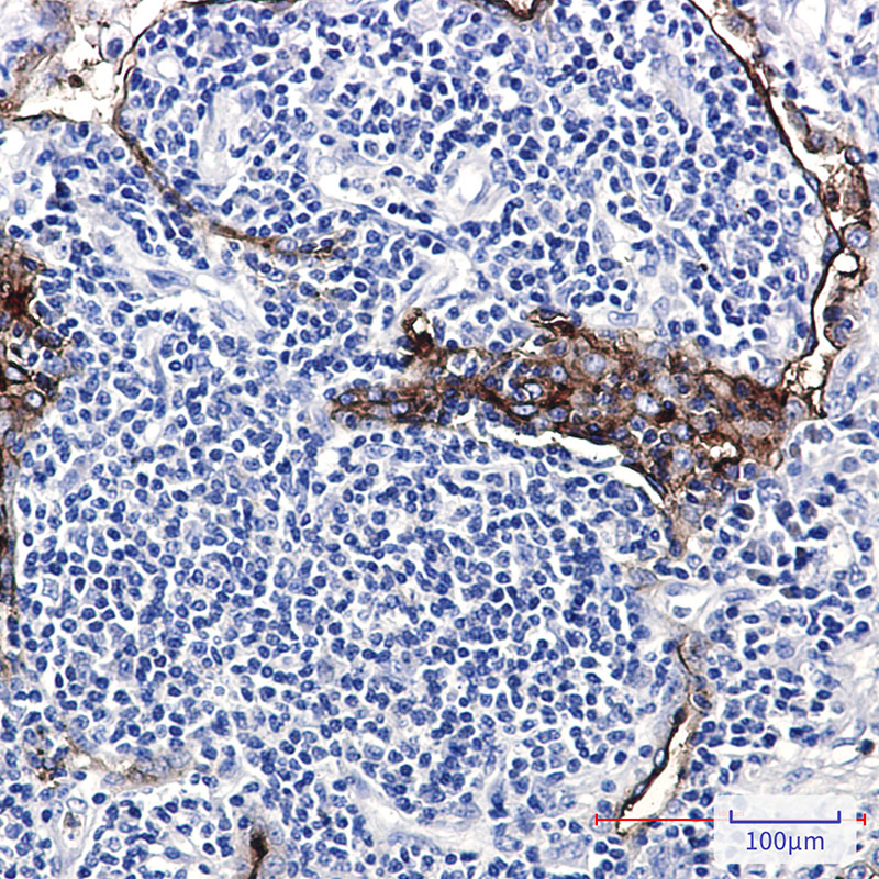 2 - Folate Binding Protein/FBP Rabbit mAb AP75447