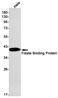 1 - Folate Binding Protein/FBP Rabbit mAb AP75447