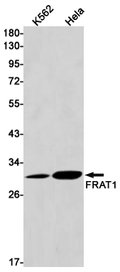 8 - FRAT1 Rabbit mAb AP75457