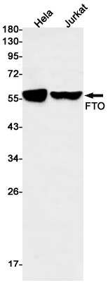 1 - FTO Rabbit mAb AP75458