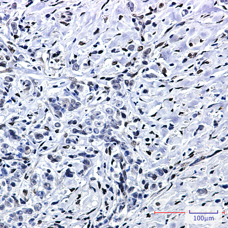 2 - FTO Rabbit mAb AP75459