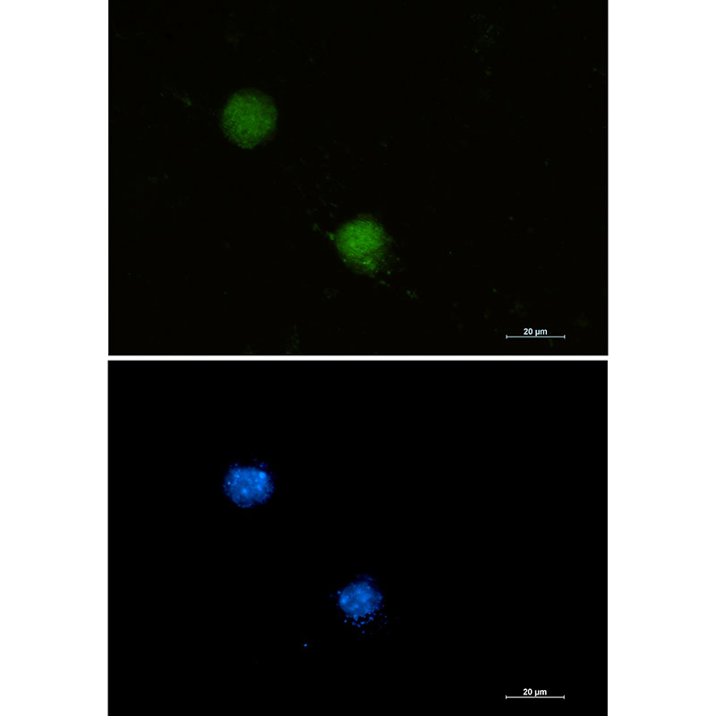 1 - FUBP1/FBP Rabbit mAb AP75461