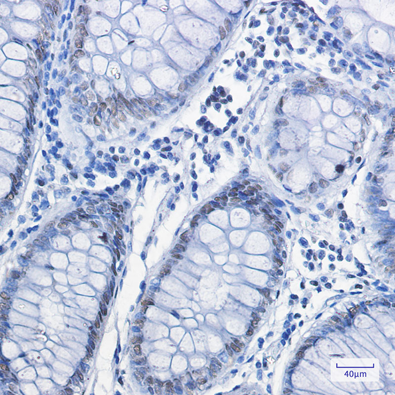 4 - FUBP1/FBP Rabbit mAb AP75461