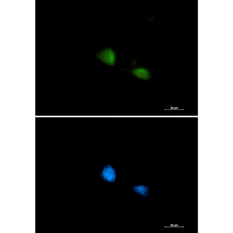 1 - FUBP1/FBP Rabbit mAb AP75462