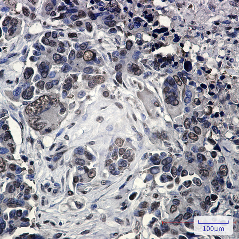 4 - FUBP1/FBP Rabbit mAb AP75462
